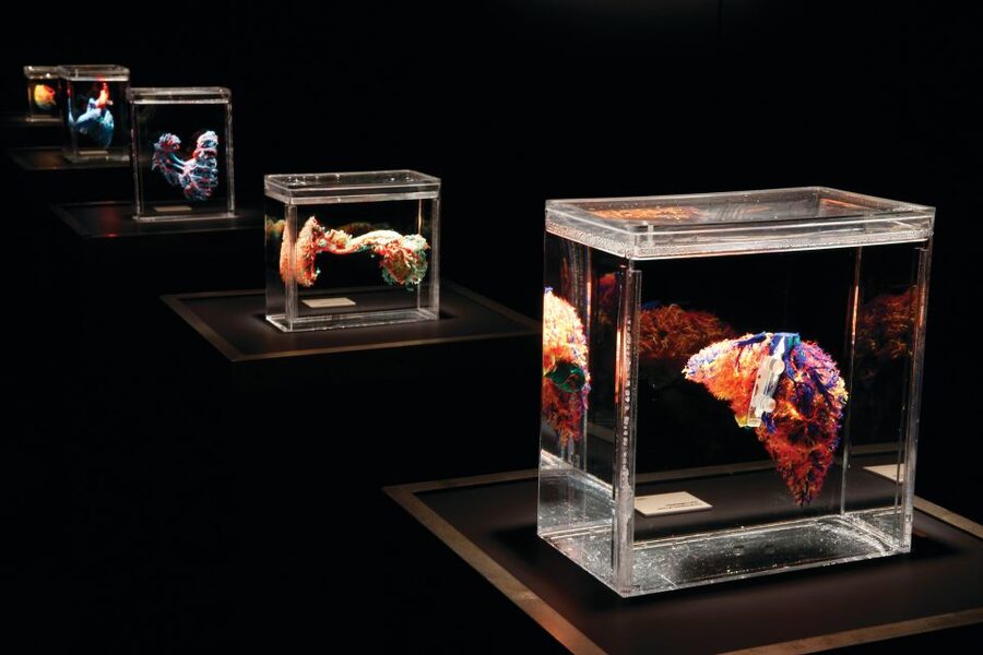 Las Vegas: BODIES | The Exhibition at the Luxor - Bodies...The Exhibition at the Luxor: what you will see (and why it sticks)